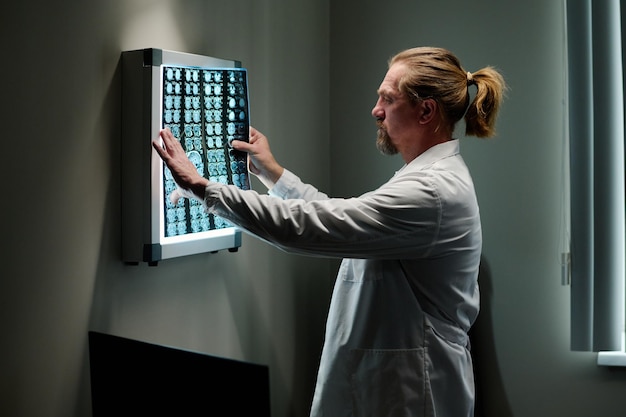 A radiologist reviewing a mammogram on a high-resolution monitor, with AI-generated annotations highlighting areas of concern suggesting potential abnormalities.